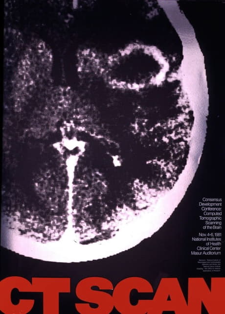CT扫描