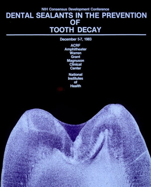 National Institutes of Health - Dental sealants in the prevention of tooth decay